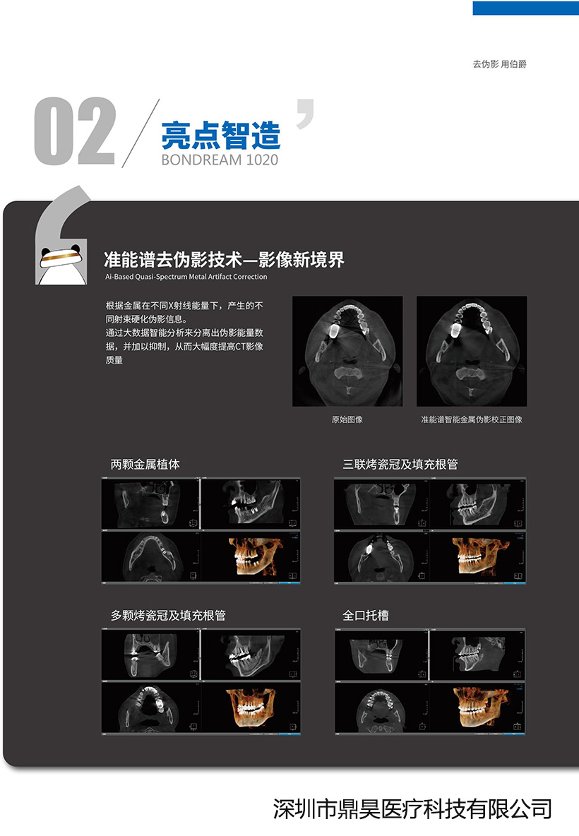 伯爵1020MS CBCT